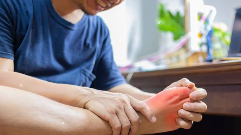 Uric acid को कम करने के घरेलू नुस्खे - home remedies to treat uric acid 6 home remedies to treat uric acid